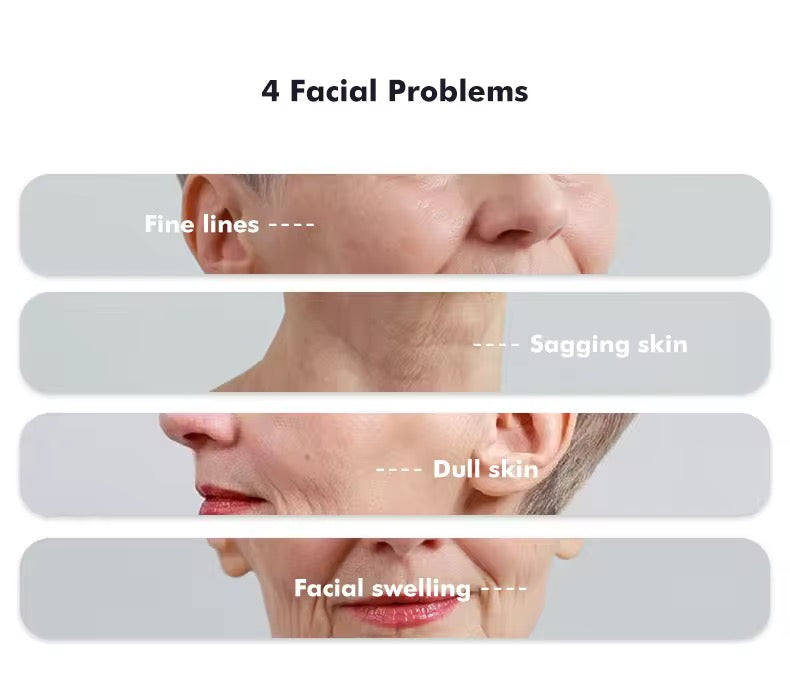 EMS RF Facial Device with Red Light Therapy
